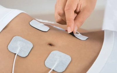 Elettrostimolazione Muscolare: il trattamento che rimodella il corpo senza fatica