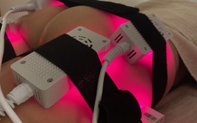 Lipolaser